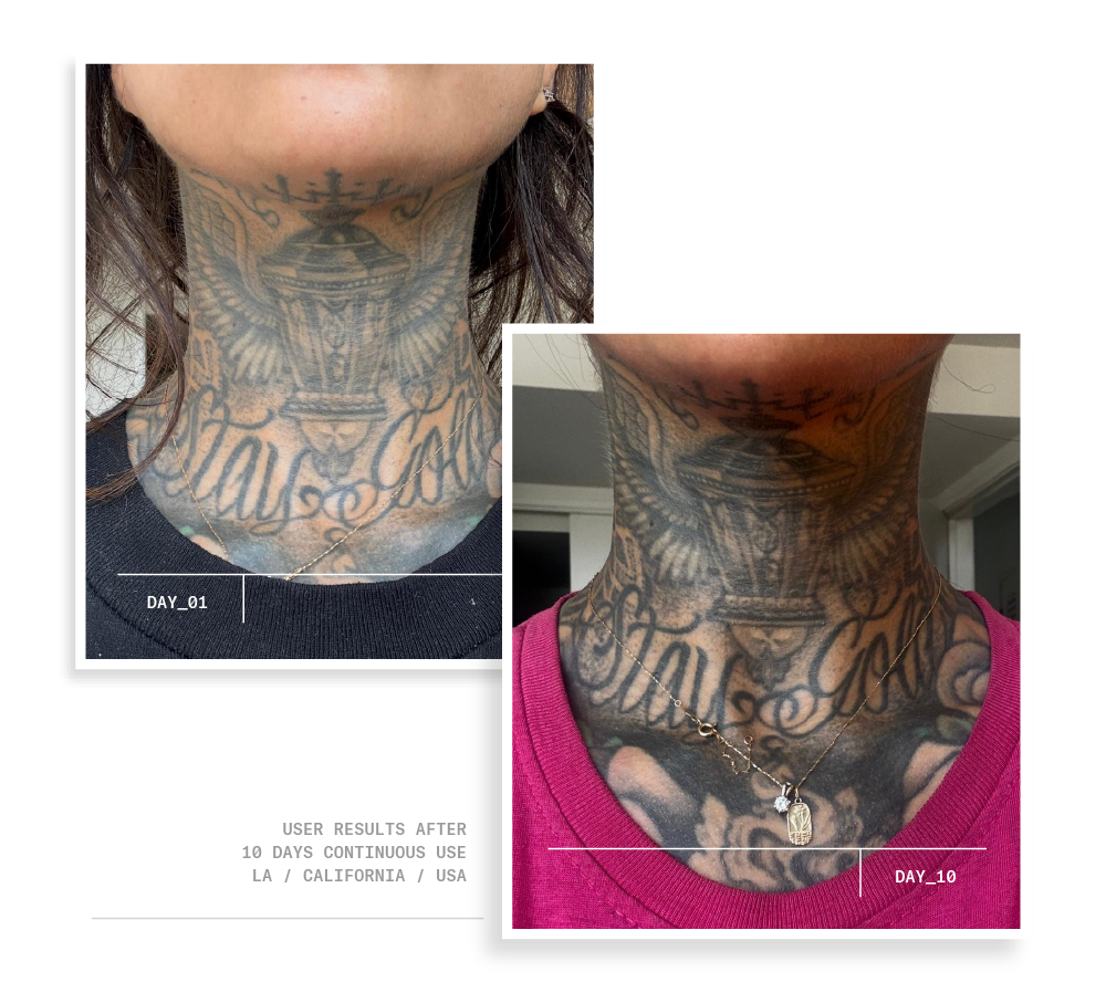 50mL | 1.7 fl oz, 30mL | 1.0 fl oz